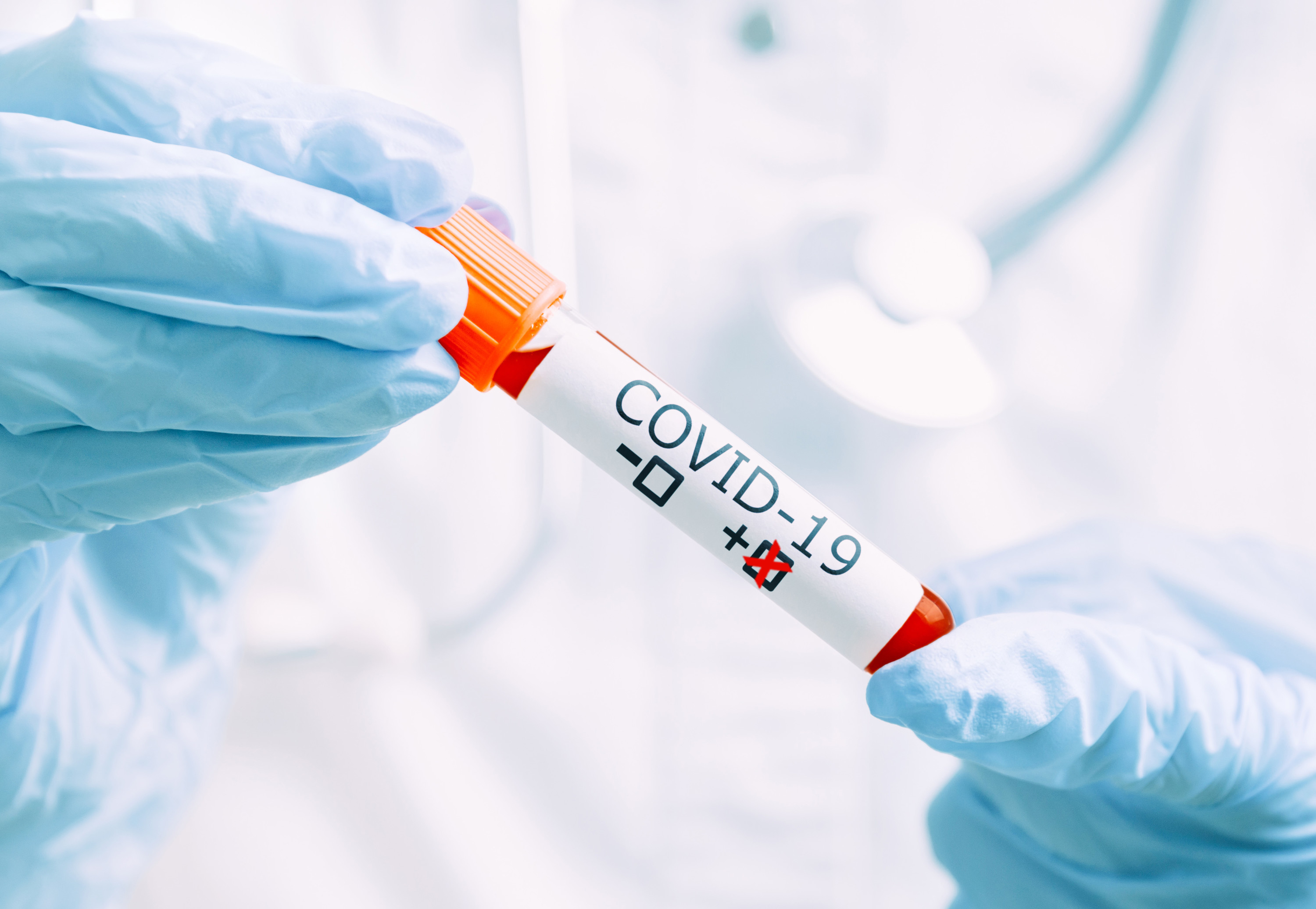 public health officials report new covid 19 cases in midwestern ontario friday