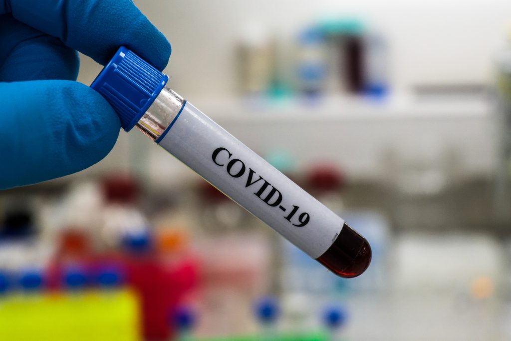 covid 19 case count increases at a steady pace friday