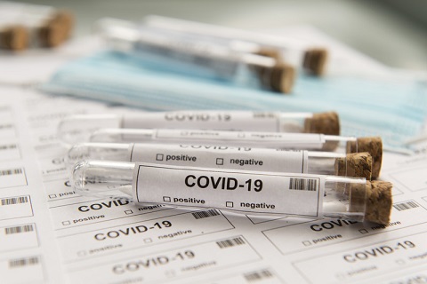 new covid 19 cases reported across the region
